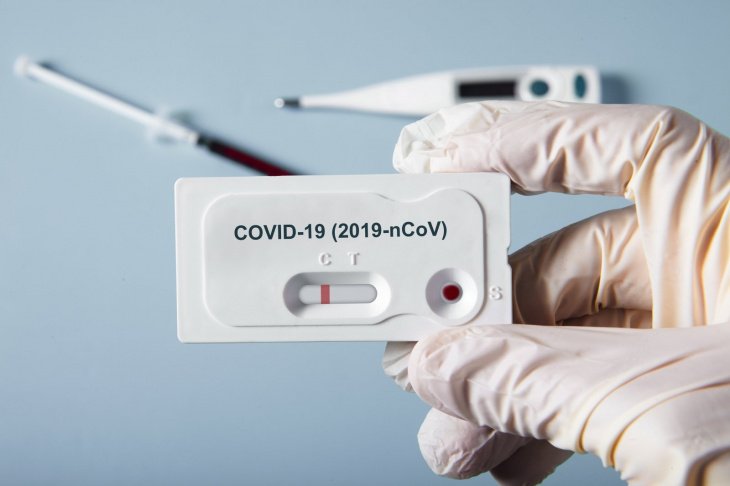 В Узбекистане в ближайшее время могут начать экспресс-тестирование на выявление антител к коронавирусу 