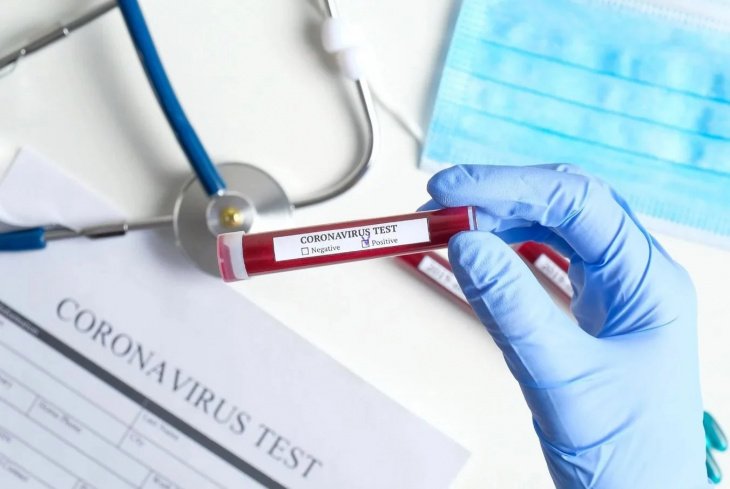Новое решение Специальной комиссии: частные клиники Узбекистана не будут проводить анализы на коронавирус