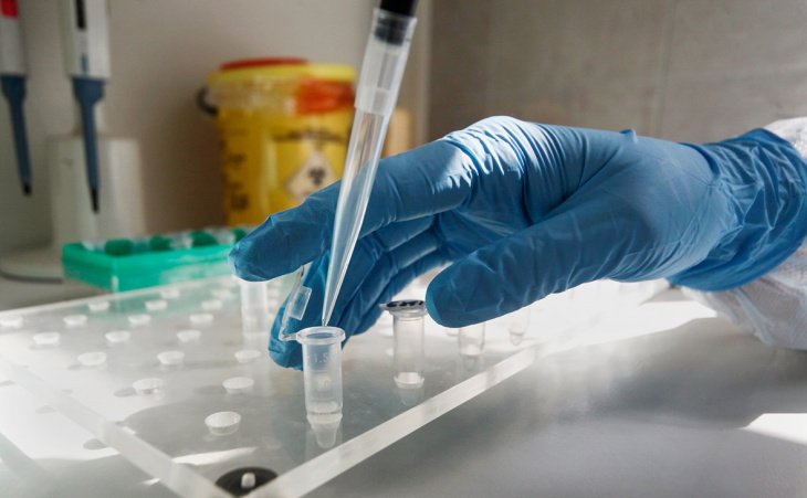 Узбекский врач предложил собственную разработку для лечения коронавируса