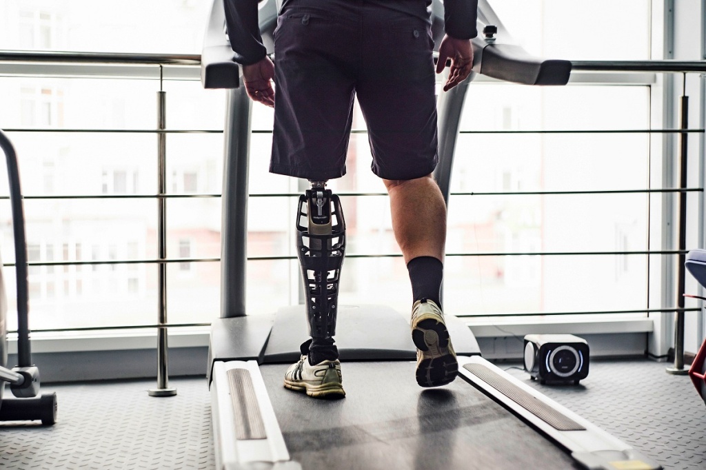 В этом году в Узбекистане для людей с особыми потребностями начнут внедрять систему протезирования