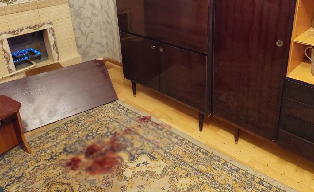 В Кагане мужчина получил удар ножом за то, что неправильно истолковал гостеприимство хозяйки дома