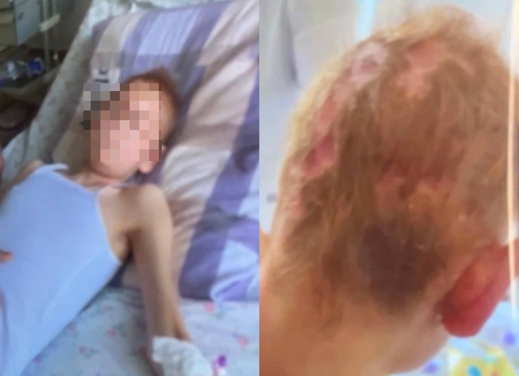 Школьница из Ангрена попала в реанимацию после месяцев изнасилований