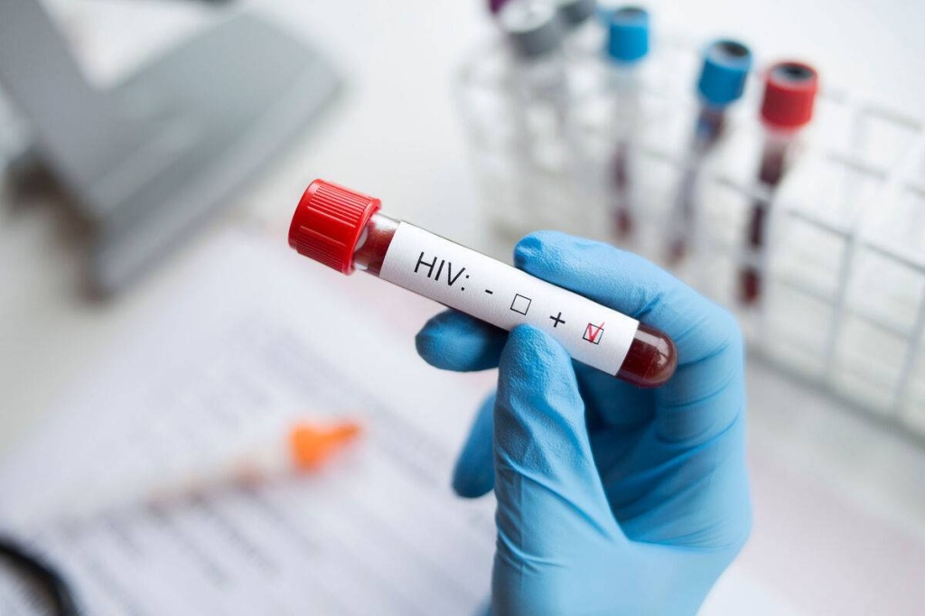В Джизакской области возбудили уголовные дела за умышленную передачу ВИЧ