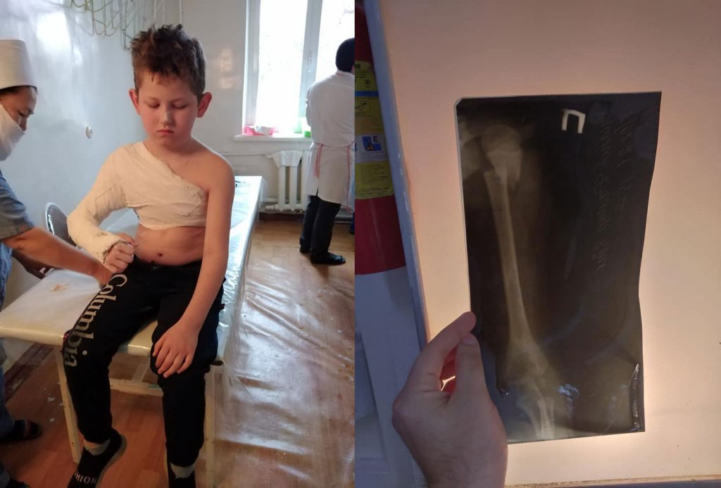 Восьмилетнему ребенку сломали руку на детской площадке. Отец обвиняет в бездействии махаллю и участкового